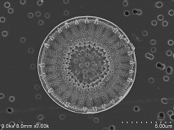Diatoms-conductive-staining3